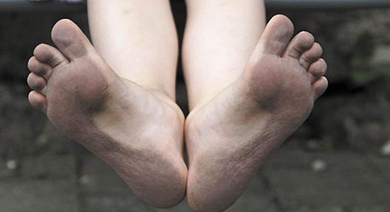 Ilustrační foto: Pixabay
